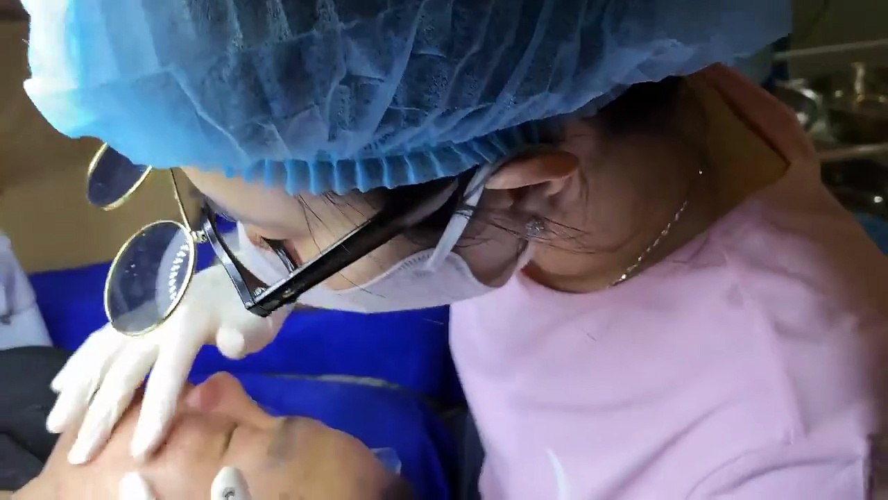 Blackhead remover