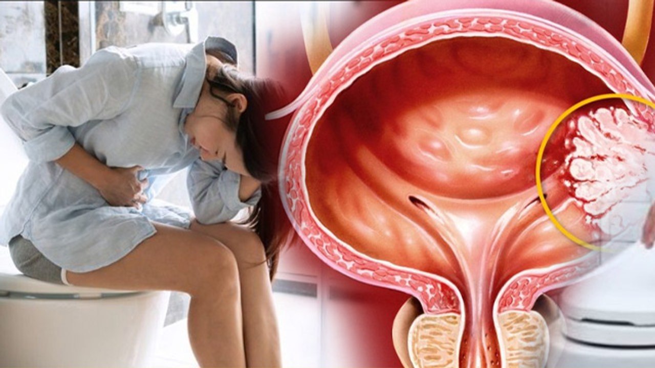 Peshab Jaisa Lagna: बार बार पेशाब जैसा लगना लेकिन होना नहीं,कारण,इलाज,घरेलू उपाय ?