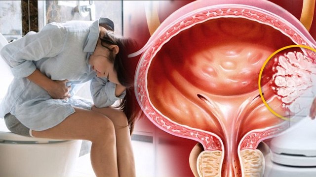 Peshab Jaisa Lagna: बार बार पेशाब जैसा लगना लेकिन होना नहीं,कारण,इलाज,घरेलू उपाय ?