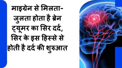 माइग्रेन से मिलता-जुलता होता है _ब्रेन ट्यूमर का सिर दर्द, सिर के इस हिस्से से होती है दर्द की शुरुआत
