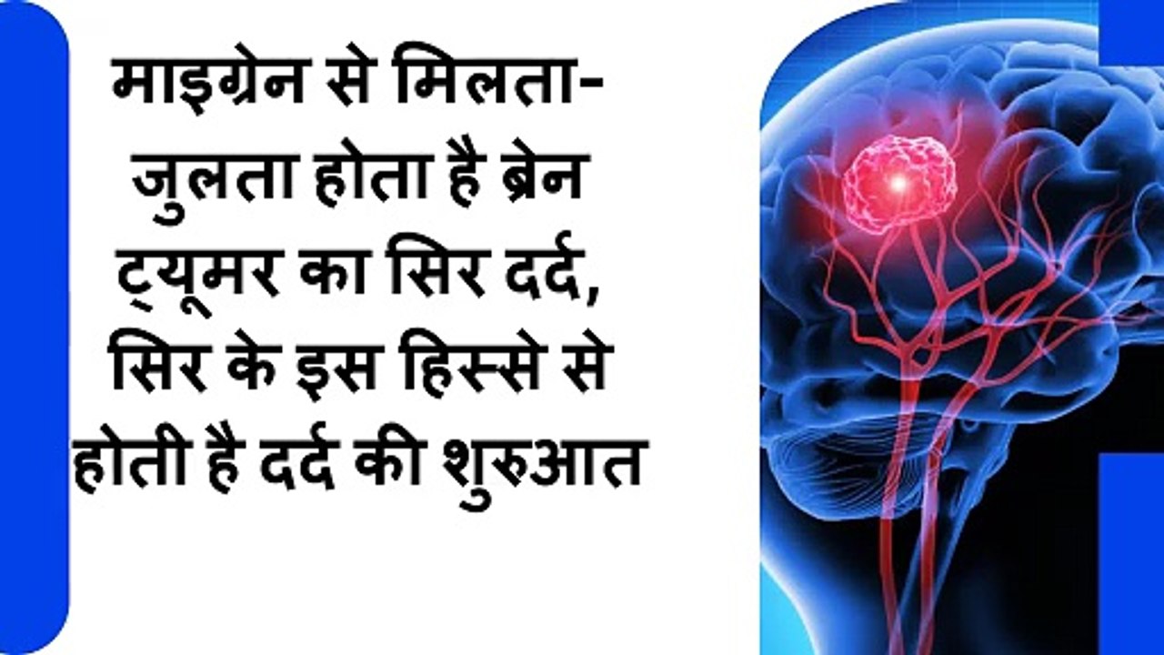 माइग्रेन से मिलता-जुलता होता है _ब्रेन ट्यूमर का सिर दर्द, सिर के इस हिस्से से होती है दर्द की शुरुआत