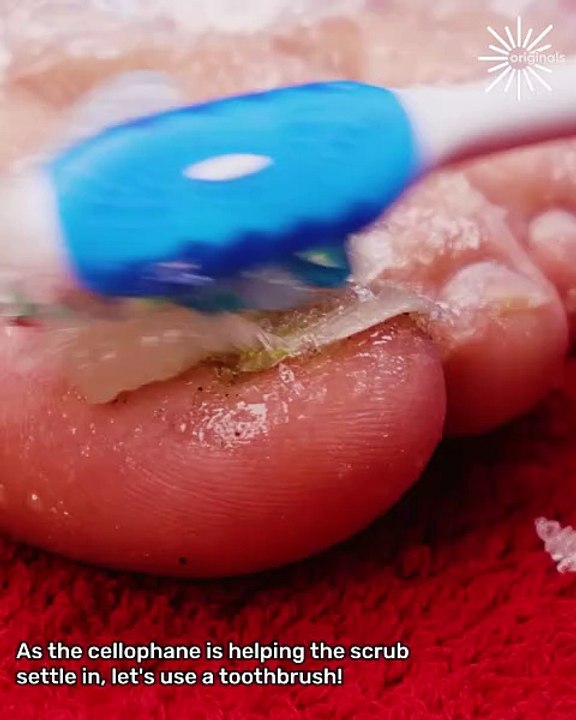 Toe-tally fabulous makeover! 💅👣