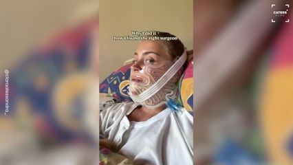 Double-jaw Surgery Brings Relief After Years of Pain