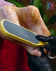 Incredible pedicure transformation! 👣