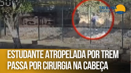 Estudante atropelada por trem passa por cirurgia na cabeça