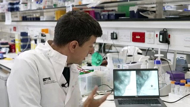 Breakthrough in treating rare baby lung condition