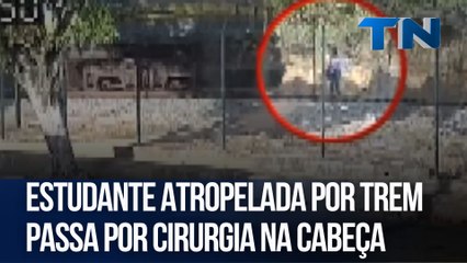 Estudante atropelada por trem passa por cirurgia na cabeça