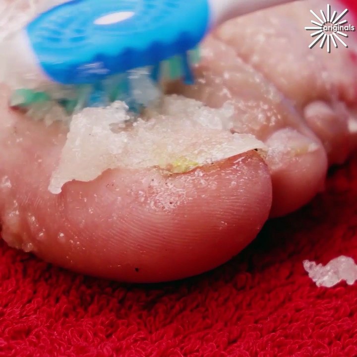 An epic pedicure transformation!