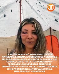 Una mujer en Turquía sorprendió al dejarse cubrir por miles de abejas que la picaron en el rostro