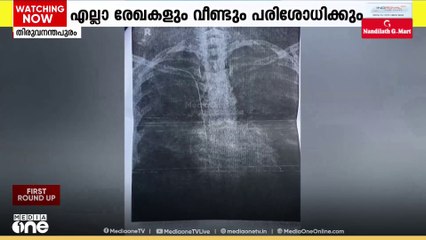 ജനറൽ ആശുപത്രിയിലെ ചികിത്സാ പിഴവ്; 'ഡോ. രാജീവ് കുമാറിന്റെ സര്‍വീസ് ഹിസ്റ്ററി പരിശോധിക്കും'