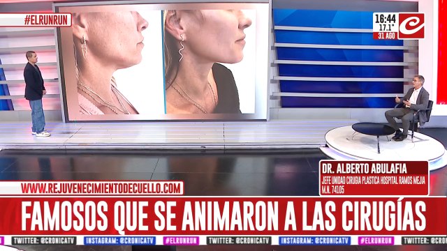 Famosos que se animaron a las cirugías para sacarse la papada