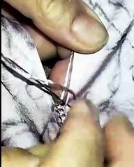 الخياطه الراندة ضريس بغرزة وحيد