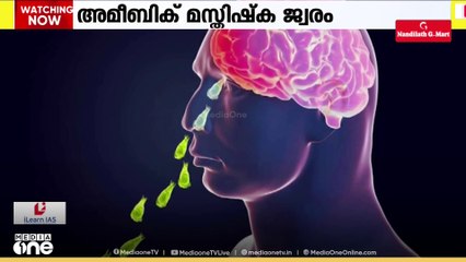 അമീബിക് മസ്തിഷ്കജ്വരം: 24 മണിക്കൂറിനിടെ മരിച്ചത് 3 മാസം പ്രായമായ കുഞ്ഞടക്കം 2 പേർ; 10 പേർ ചികിത്സയിൽ