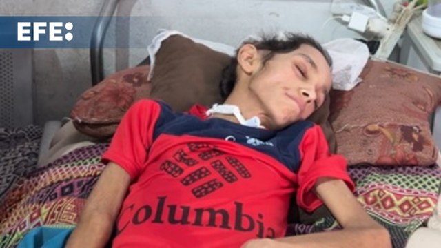 Los efectos de la hambruna en Gaza: La situación es catastrófica