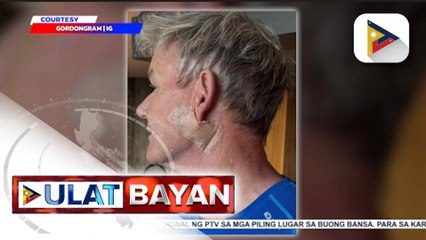 Celebrity chef na si Gordon Ramsay, sumailalim sa isang medical treatment para sa sakit na skin cancer | ulat ni Ice Martinez