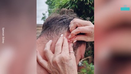 Popping Pimple Turns Explosive