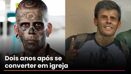 Homem que já foi o mais tatuado do Brasil mostra rosto após retirar tatuagens: ‘Dignidade devolvida’