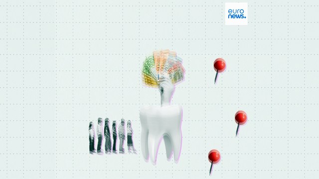 Quali sono i paesi dell'Ue che hanno più difficoltà ad accedere alle cure dentistiche?
