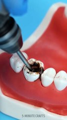 How dental surgery really looks through the doctor’s eyes🦷