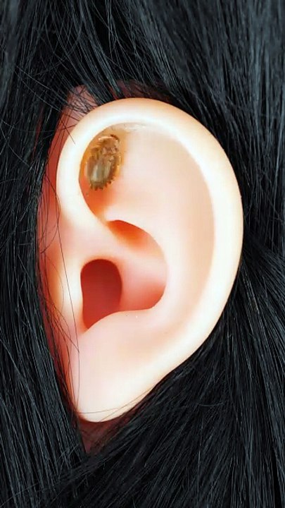 OMG! 🤯 A Cockroach in Her Ear?! Funny Prank Model 😂