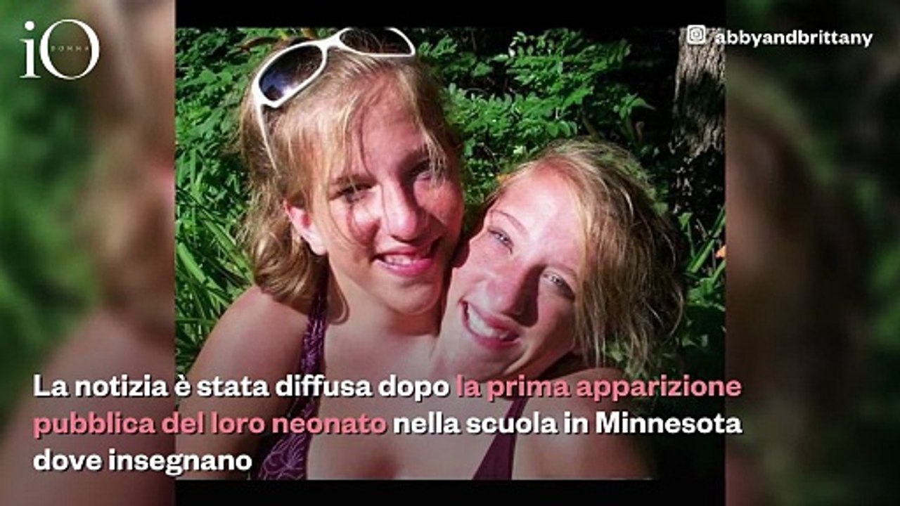 Abby e Brittany Hensel, le celebri gemelle siamesi sono diventate mamme