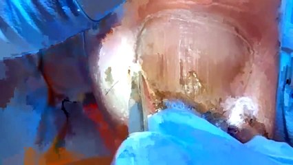 Two amazing Nails hidden