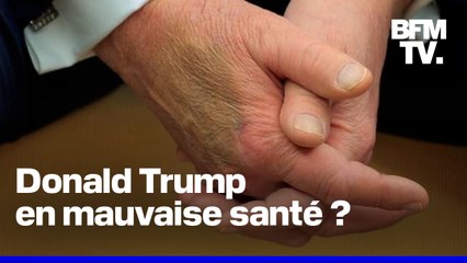 Pourquoi l’apparition de Donald Trump ne suffit pas à calmer les rumeurs sur son état de santé