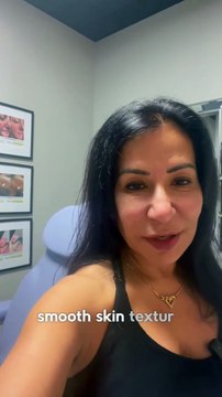 How Microneedling Helps with Scars and Skin Texture