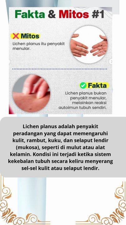 apa itu lichen planus itu dan fakta dan mitos yang menyertainya
