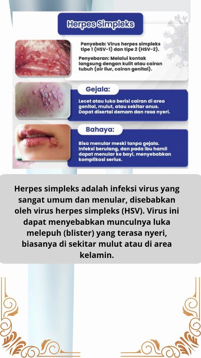 apa itu penyakit hespes simpleks penyebab gejala dan apa saja bahaya nya untuk kita