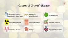 Causes of Grave's disease
