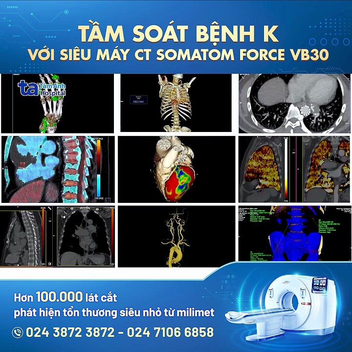 Giá gói tầm soát ung thư toàn diện: Gồm những gì và chi phí ra sao?