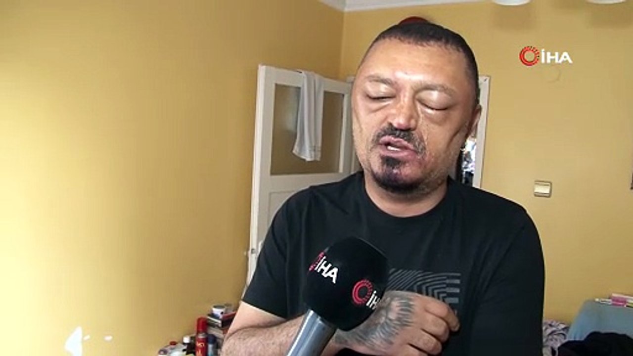 Adana’da saç şampuanı kabusu! Yüzü şişti, gözünü kaybetme tehlikesi yaşadı