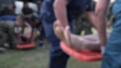 Revelan el grave estado de salud de los soldados que quemaron vivos en Putumayo