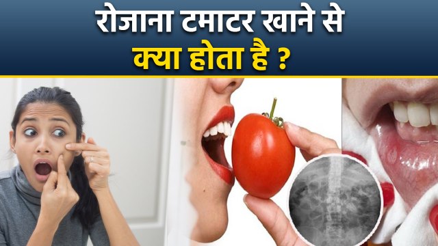 Roj Tamatar Khane Se Kya Hota Hai,टमाटर खाने के फायदे | खाने का सही तरीका | Boldsky
