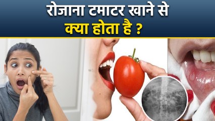 Roj Tamatar Khane Se Kya Hota Hai,टमाटर खाने के फायदे | खाने का सही तरीका | Boldsky