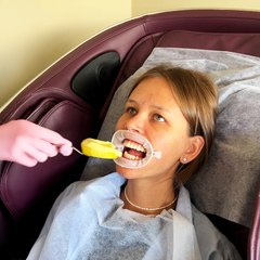 DIY Custom-fit grills 💎 from a simple mold 🦷