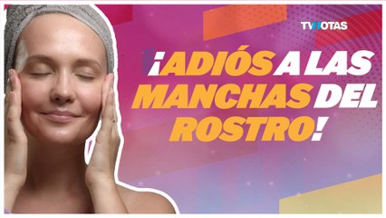 Los mejores tratamientos y remedios para manchas en el rostro; ¡Luce una piel perfecta en semanas!