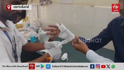 ಬಾಗಲಕೋಟೆ: ಅಂಧ ಮಕ್ಕಳು ಸೇರಿ 15 ಮಂದಿಗೆ ಹುಚ್ಚು ನಾಯಿ ಕಡಿತ: ಜಿಲ್ಲಾಸ್ಪತ್ರೆಯಲ್ಲಿ ಚಿಕಿತ್ಸೆ