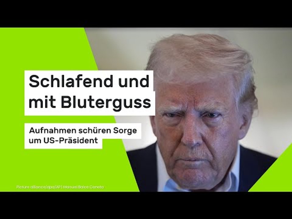 Schlafend und mit Bluterguss - Aufnahmen schüren Sorge um US-Präsident