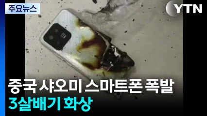 중국에서 샤오미 스마트폰 폭발...3살배기 화상 / YTN
