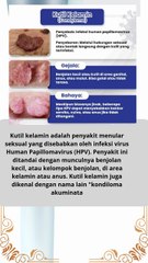 apakah penyakit kutil kelamin penyebab gejala dan bahaya nya bagi kita  #news