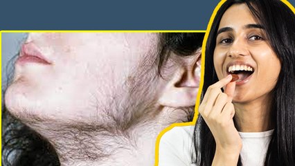 Hair Gunmies Side Effects: क्या हेयर ग़मी खाने से शरीर पर बाल ज्यादा आते है…। Boldsky