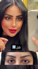 ريماس منصور تستعرض عملية قص جفونها وتثير الانتقادات