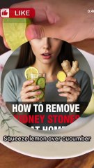 How to remove kidney stones naturally in a month