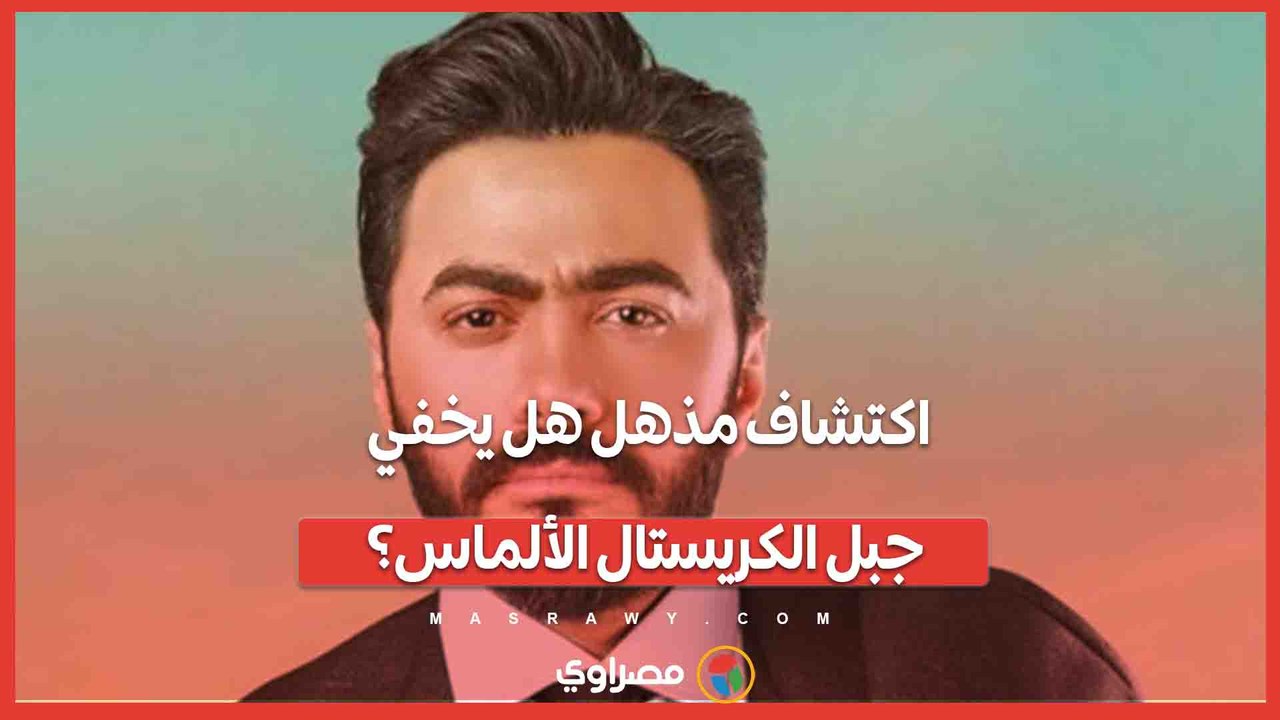 "بيتعالج من فترة ومقالش لحد".. ما قصة دخول تامر حسني المستشفى؟