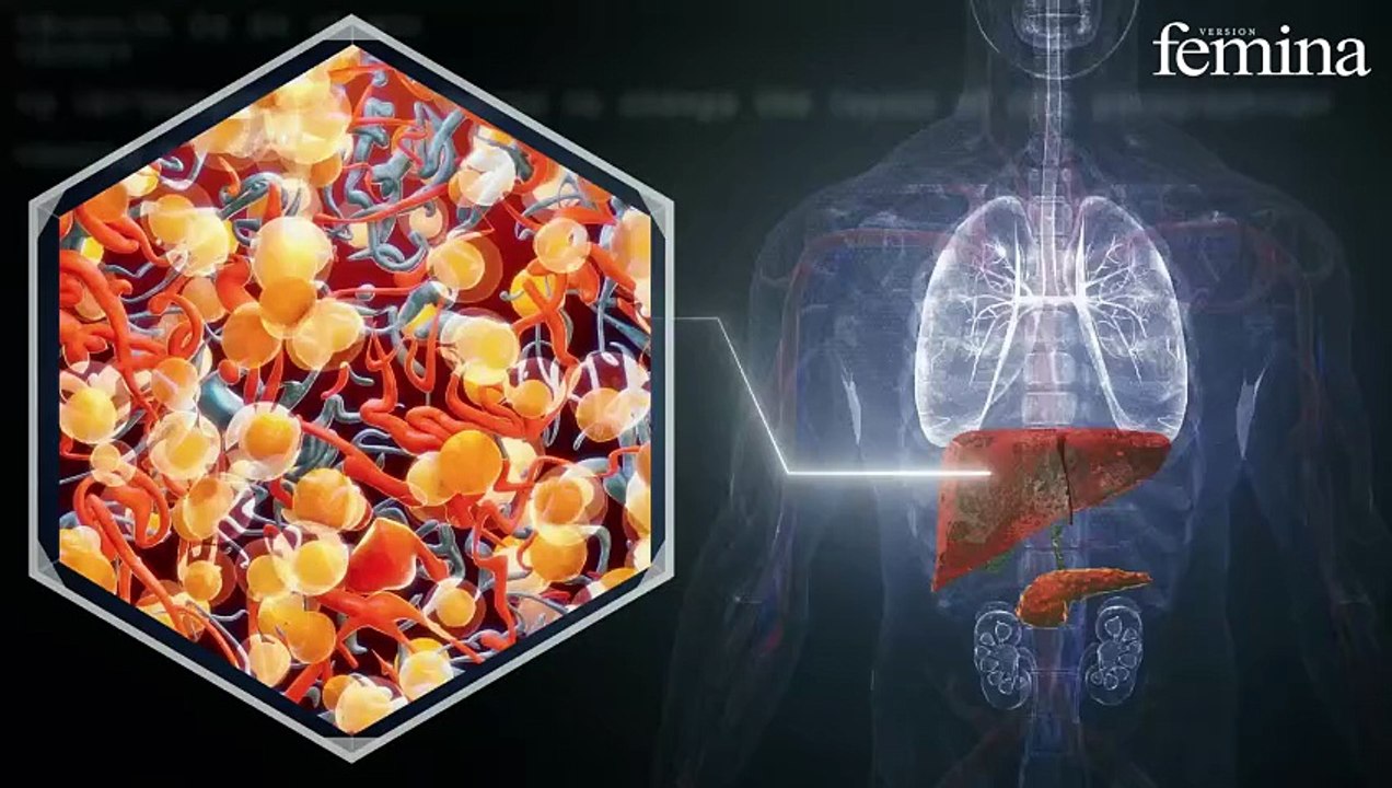 Cette maladie silencieuse augmente le risque de cancer du foie (et reste trop méconnue)