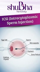 🧬 ICSI: Intracytoplasmic Sperm Injection 🧬