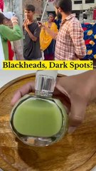 Say Goodbye to Blackheads & Whiteheads! 🌿💆‍♀️ Dr. Upasna Vohra recommends Tulsi & Rice Spray. Use 1-3 times a day for clear, glowing skin! 💫"