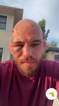 Jean Silva’s face the morning after his #NocheUFC defeat to Diego Lopes